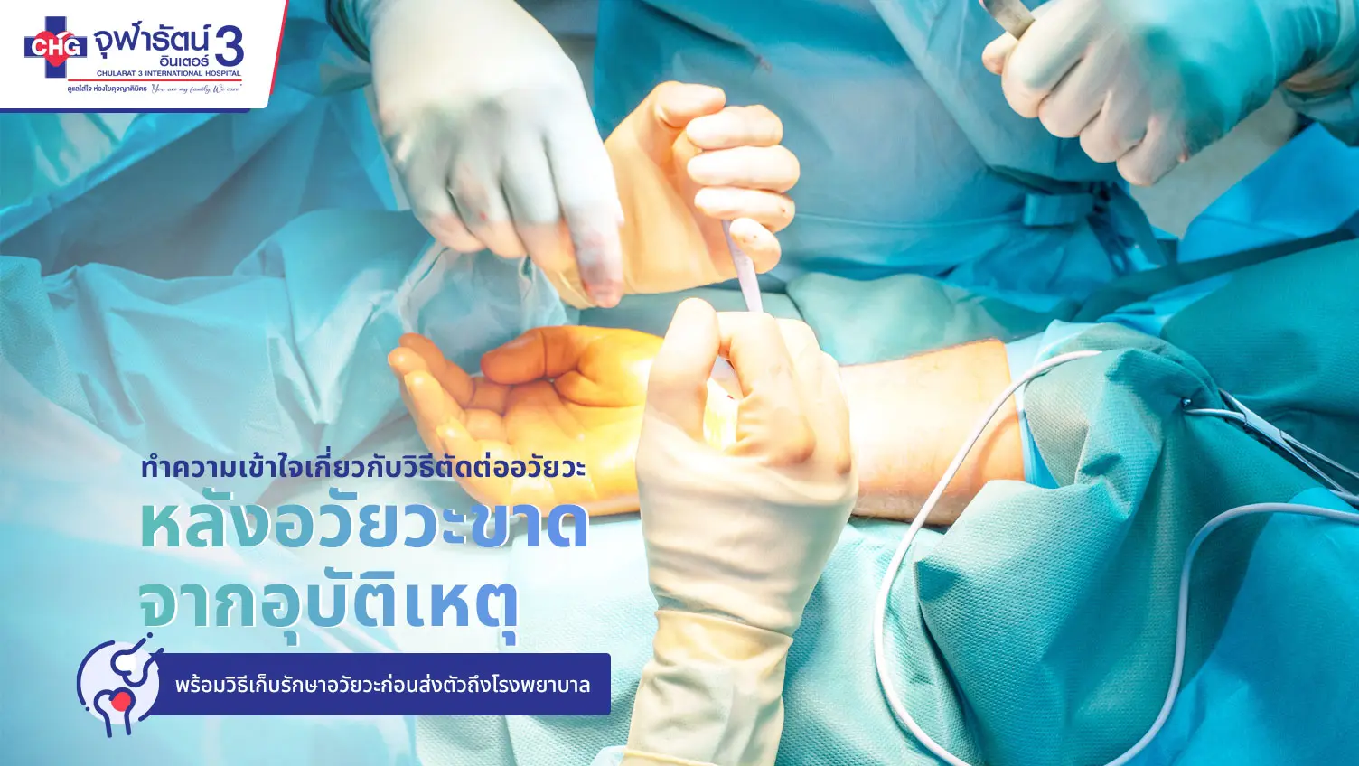 article-วิธีตัดต่ออวัยวะ และวิธีเก็บรักษาอวัยวะที่ขาดอย่างถูกต้อง