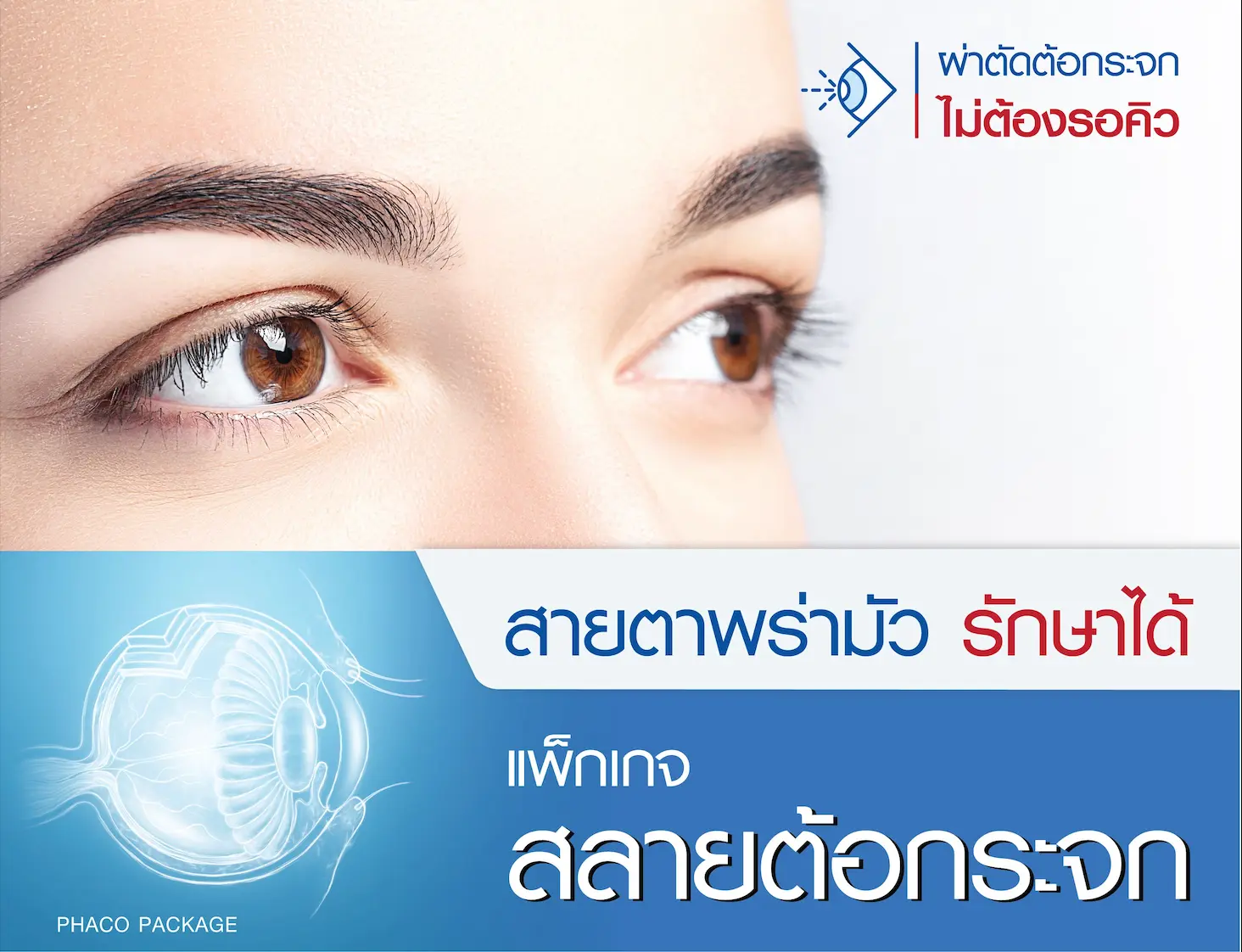 article-แพ็กเกจสลายต้อกระจก