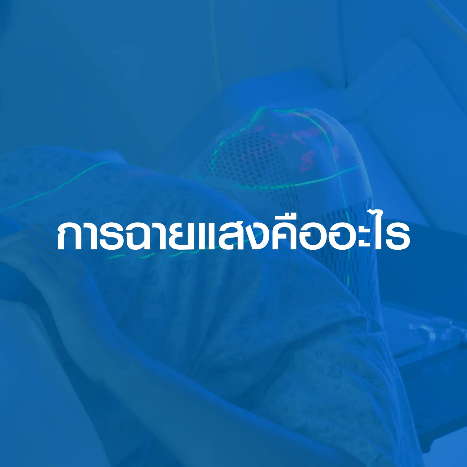 article-การฉายแสงคืออะไร