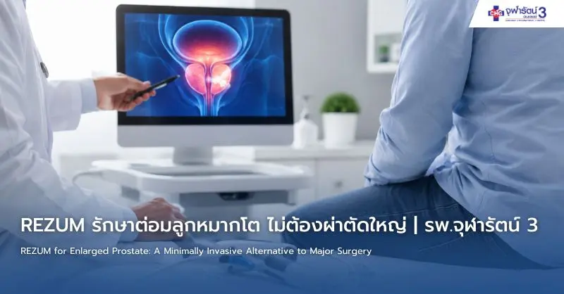 article-1