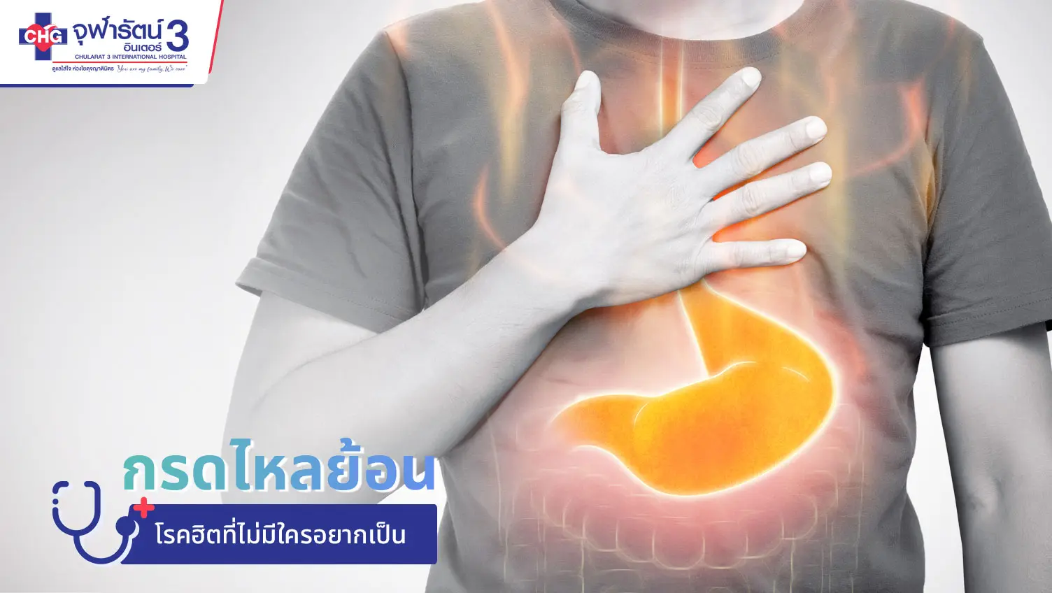 article-กรดไหลย้อน...โรคฮิตที่ไม่มีใครอยากเป็น